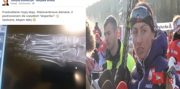 Spokojnie biegam dalej…czyli o stopie, która interesuje się cały świat