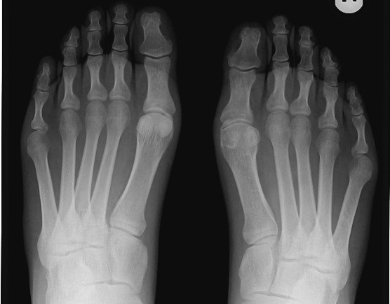 Sadeczanin.info. „Kowalczyk może biec ze złamaną nogą, to pan też…”